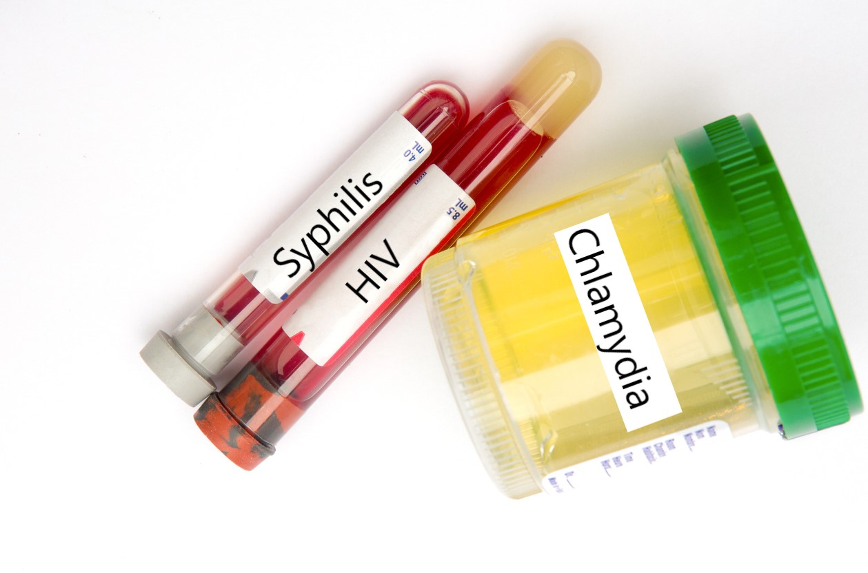 What young people need to know about STIs